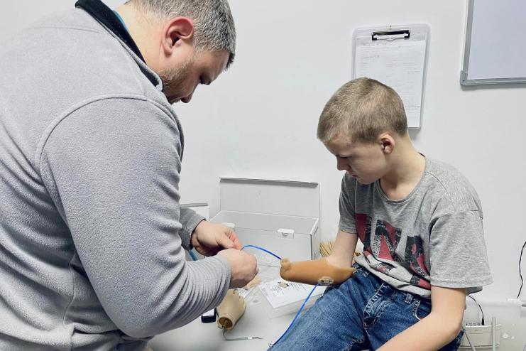 13-річному сину захисника з Одещини, який втратив руку внаслідок нещасного випадку, виготовляють протез